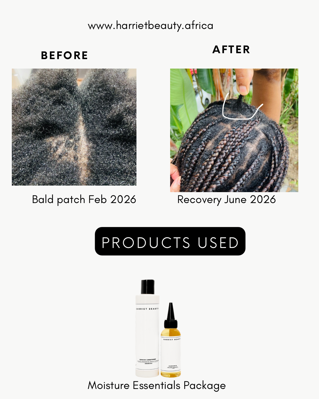 Moisture Essentials Package